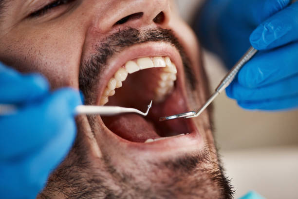 Best Emergency Orthodontic Repairs in Catahou, LA